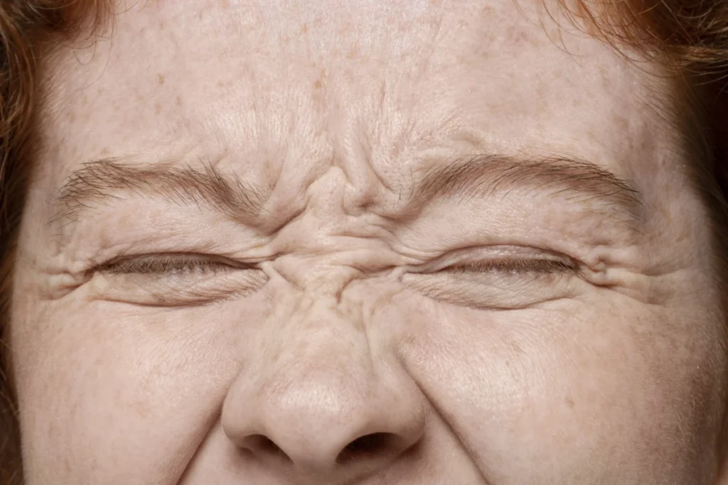 Envelhecimento Precoce: Causas, Sintomas e Prevenção. Close-up da textura dos poros faciais.